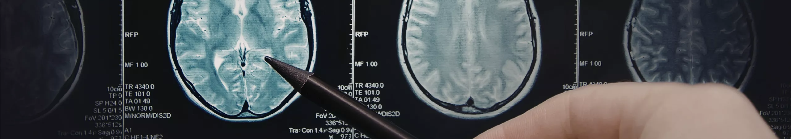 nephrology-6981d1771b9fc