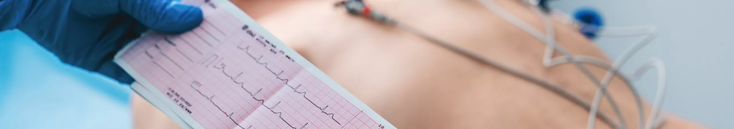 2d-echo-69a967fa0a655