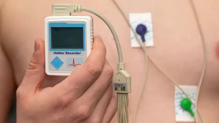 holter-monitor-1-69afe8bd428be