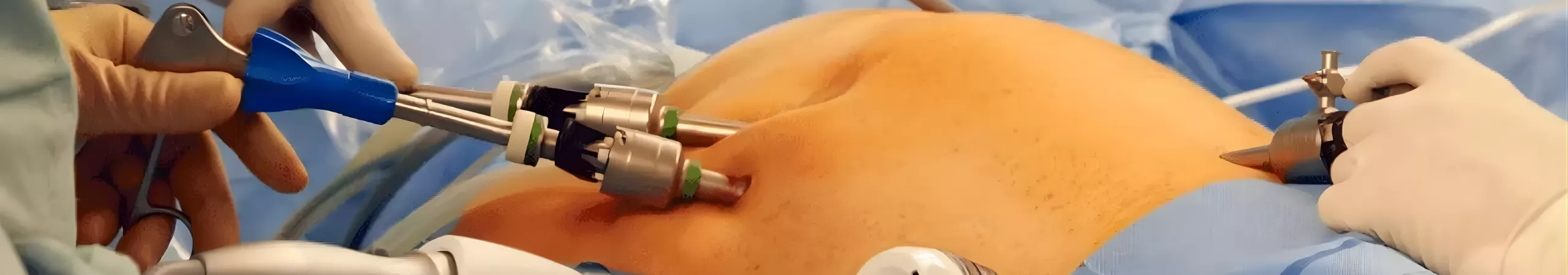 onco-surgery-69b00b57819b0